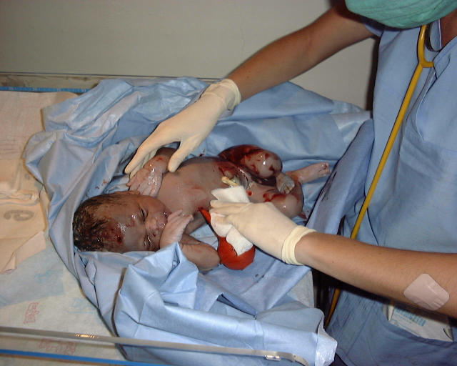 Newborn